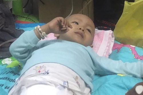 Bé trai bị u nguyên bào thần kinh
