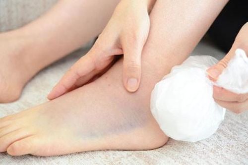 Xử lý kịp thời và đúng cách vùng bị sưng đau do bong gân