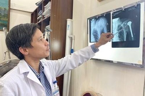 Bệnh viện Việt Đức thay khớp vai và khớp háng cho bệnh nhân bị ung thư phổi