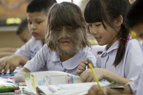 Top 10 người 'quái dị' nhất thế giới: Việt Nam cũng có một cái tên, đó là ai?
