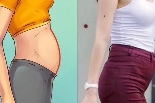 Phân biệt béo phì với sự đầy đặn của thiếu nữ tuổi dậy thì