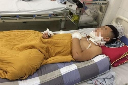 Mâu thuẫn tại quán ăn đêm, cầm kéo truy sát đối thủ trọng thương