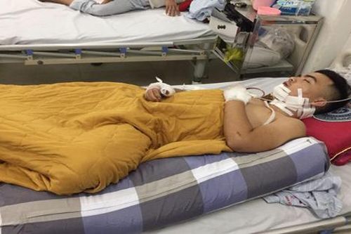 Đi ăn khuya, nam thanh niên bị truy sát