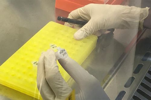 Người có tiếp xúc với nữ bệnh nhân dương tính với Covid-19 ở Đà Nẵng có kết quả xét nghiệm âm tính