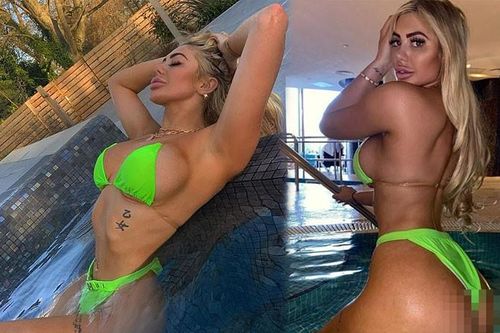 Vòng một bất thường của 'mỹ nhân dao kéo' Chloe Ferry