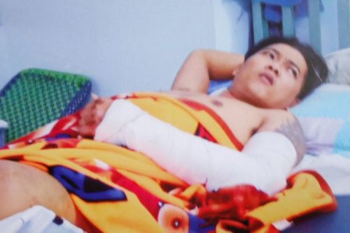 Giúp anh Đạt khổ vì tai nạn giao thông