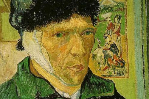 Tại sao 1977 Vlog nói Van Gogh không thể đeo khẩu trang?