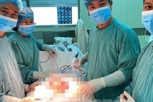 Bóc tách khối u 9kg ra khỏi ổ bụng bệnh nhân 68 tuổi