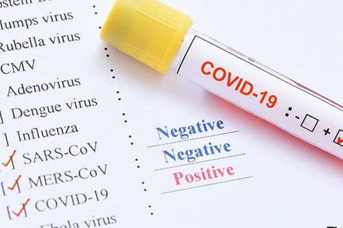 Vì sao Việt Nam tìm kiếm sự hỗ trợ kit chẩn đoán nhanh Covid-19 từ Hàn Quốc?
