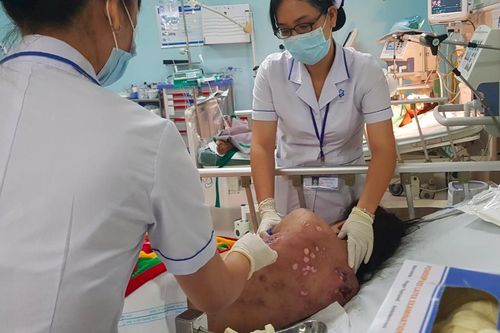 Nữ tiếp viên quán cafe bị tra tấn dã man như thời Trung cổ
