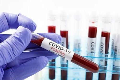 Nhóm máu có thể ảnh hưởng tới tỷ lệ mắc Covid-19