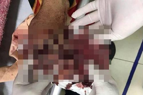 Nổ lớn tại chung cư Nghệ An, người đàn ông nát bàn tay
