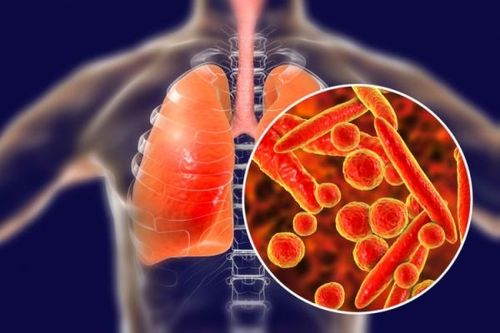 Phác đồ mới trị lao đa kháng thuốc