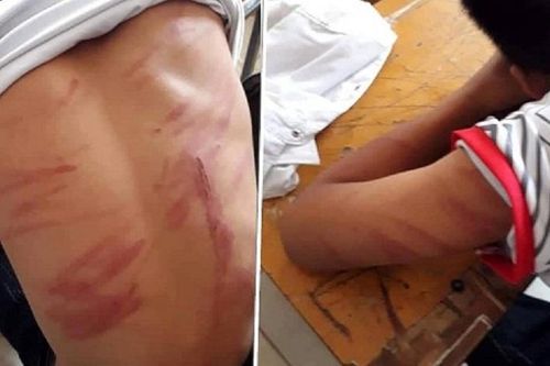 Nam thanh niên bị nhốt, đánh suốt đêm vì nghi trộm gà