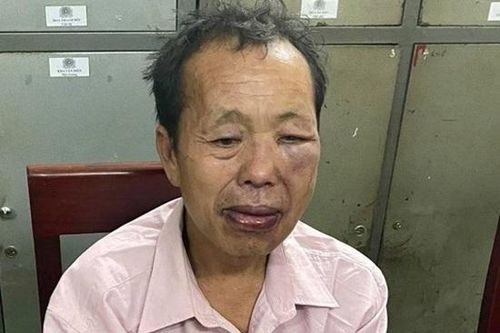 'Trùm' ma túy dùng dao tấn công khiến 2 cảnh sát bị thương