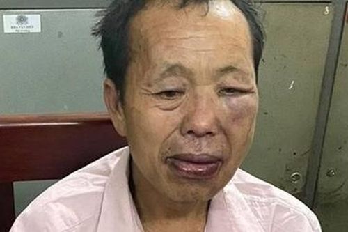 'Trùm' ma túy dùng súng và dao nhọn tấn công Cảnh sát