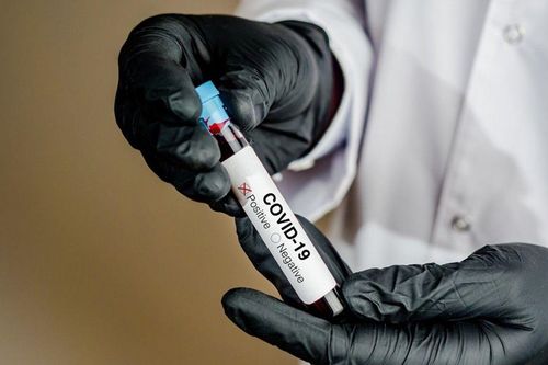 Dịch Covid-19 ở Pháp: Đỉnh dịch có thể diễn ra trong 5 đến 8 ngày tới