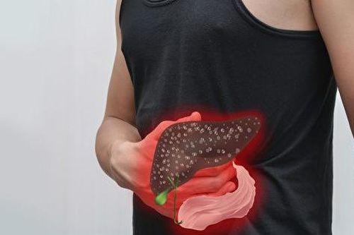 Nói không với bia rượu nhưng lại mắc ung thư gan, 2 thói quen này chính là thủ phạm