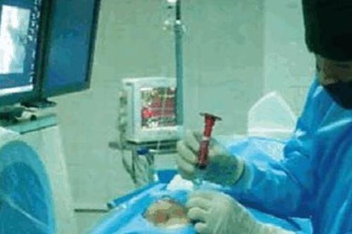 Đau giật nửa mặt đến mức 'chết đi sống lại', chỉ cần 30 phút điều trị