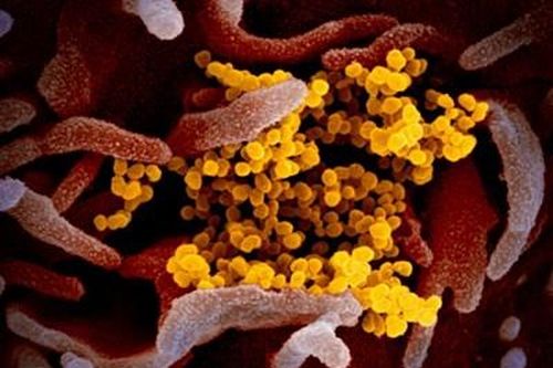 Virus Covid-19 gây bệnh cho cơ quan nào của cơ thể?