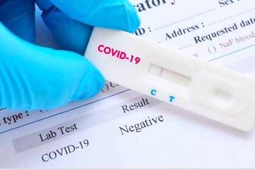 Séc phát hiện 80% dụng cụ xét nghiệm nhanh COVID-19 của Trung Quốc cho kết quả sai