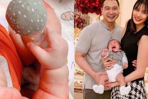 Lan Khuê xót xa chia sẻ trị chàm cho con trai 4 tháng tuổi
