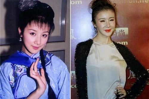 Những tượng đài nhan sắc bị hủy hoại bởi phẫu thuật thẩm mỹ