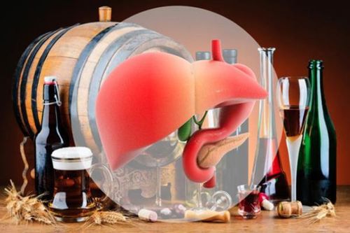 Giải pháp hỗ trợ giải độc gan hiệu quả cho người uống rượu bia