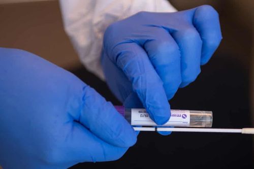 Bộ xét nghiệm SARS-CoV-2 tại nhà có gì đặc biệt?