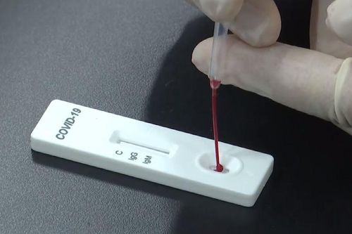 Mỗi ngày Việt Nam có thể xét nghiệm tìm COVID-19 từ 8.000 - 10.000 mẫu