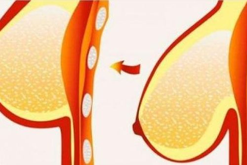 7 lời khuyên vàng giúp ngực tránh 'chảy xệ'