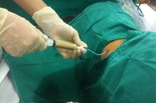 Những bệnh cảnh tiết niệu cần cấp cứu dù ngại... COVID – 19