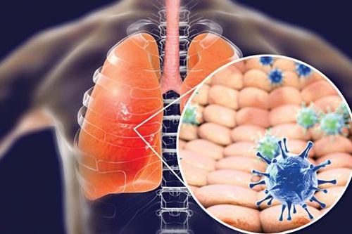 Đại dịch Covid-19 đang bùng phát: Mách bạn cách ứng phó những tình huống hoảng sợ