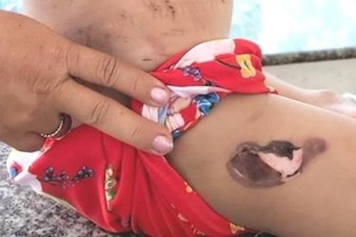 Nghi án người tình của mẹ bạo hành dã man cháu bé 4 tuổi