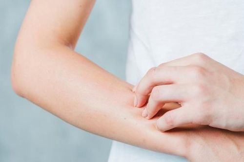 Điều trị viêm mao mạch dị ứng