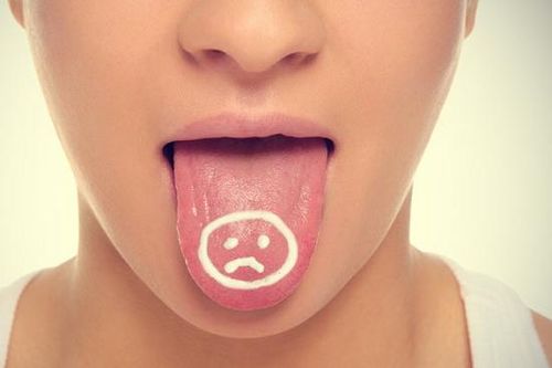 Vì sao hay loét miệng lưỡi?