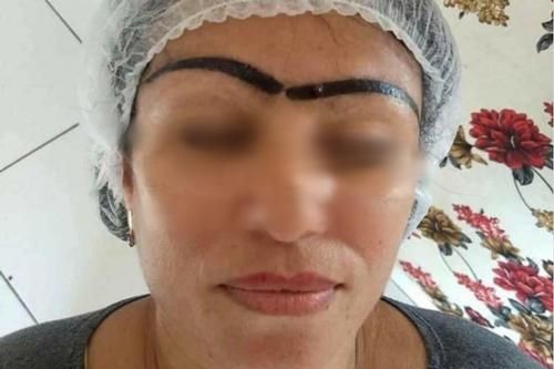 Một phen 'dở khóc dở cười' với 'thảm họa' xăm lông mày bị hỏng của người phụ nữ trung niên