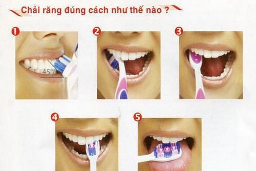 7 thói quen xấu thường gặp khi vệ sinh răng