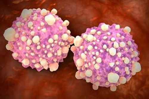 Xét nghiệm máu bằng trí tuệ nhân tạo có thể phát hiện 50 loại ung thư