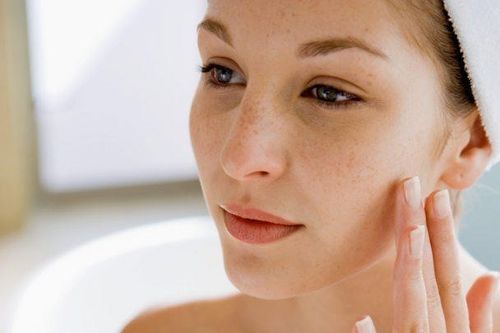 Vì sao phụ nữ Việt dễ bị nám đến vậy?