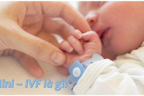 Tiết kiệm chi phí IVF với chu kỳ kích trứng tối thiểu