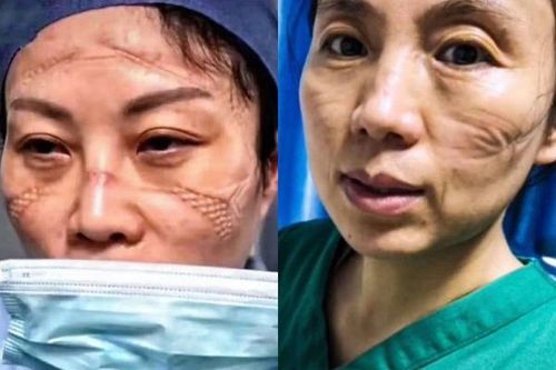 'Sự kỳ thị' - gánh nặng ngàn cân trên vai nhân viên y tế