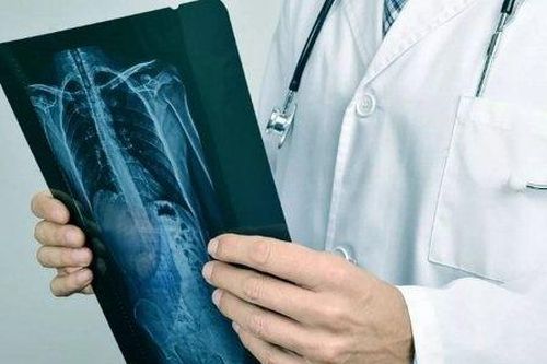 COVID-19: 3 dấu hiệu cho thấy nhiễm trùng đã ảnh hưởng đến phổi