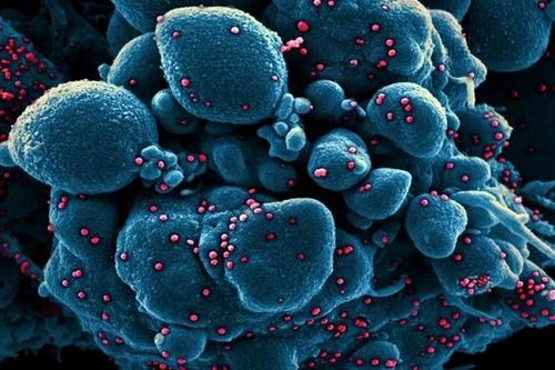 Virus SARS-CoV-2 qua ống kính hiển vi