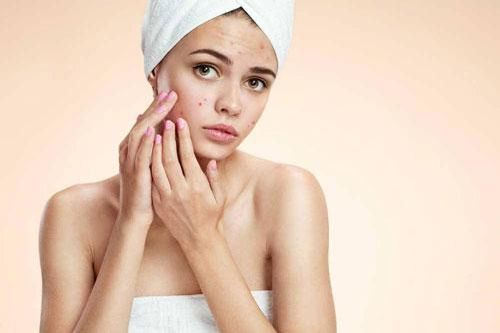 7 sai lầm tai hại khi chăm sóc da khiến mặt nổi đầy mụn: 80% người mắc phải