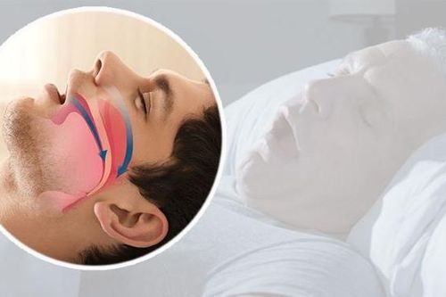 Mối liên hệ giữa chứng ngưng thở khi ngủ và bệnh Alzheimer