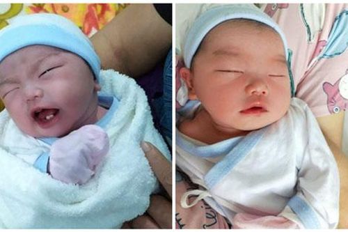 Bé sơ sinh chào đời đã có 2 răng cửa khiến các bác sĩ vô cùng bất ngờ