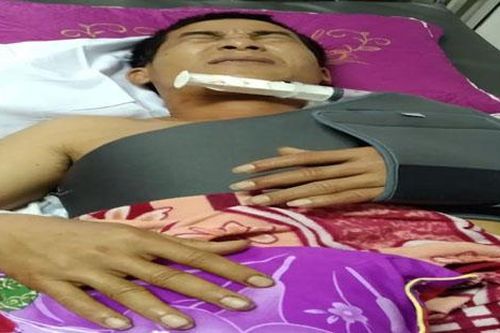 Làm đứt dây mạng, tài xế xe tải bị chém nhập viện