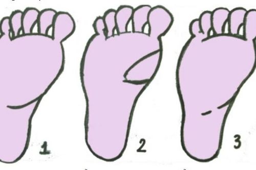 Dấu hiệu vàng trong lòng bàn chân hứa hẹn sẽ đạp trúng 'kho báu' của Thần Tài