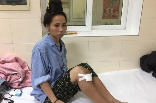 Cạn kiệt tiền chữa bệnh, cô gái dân tộc La Ha ung thư xương gặp nguy